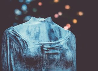 Jak rozpoznać uszkodzony napinacz? Jak rozpoznać uszkodzony napinacz?